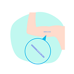 Contraceptive_Implant