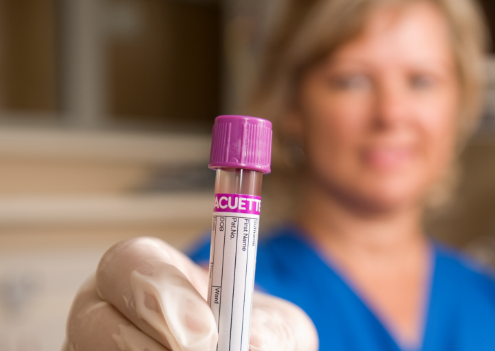 Testing for hepatitis B